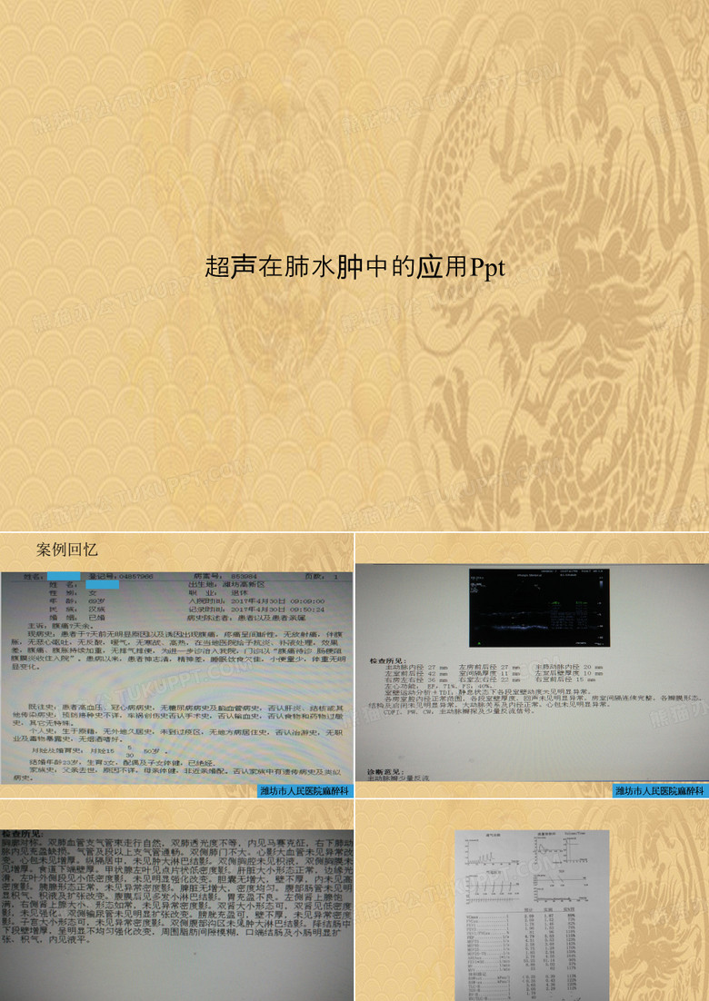 超声在肺水肿中的应用Ppt.2021优选PPT