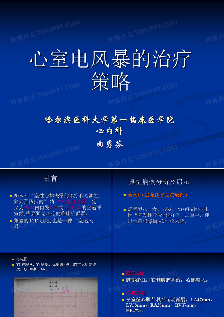 心室电风暴的治疗策略