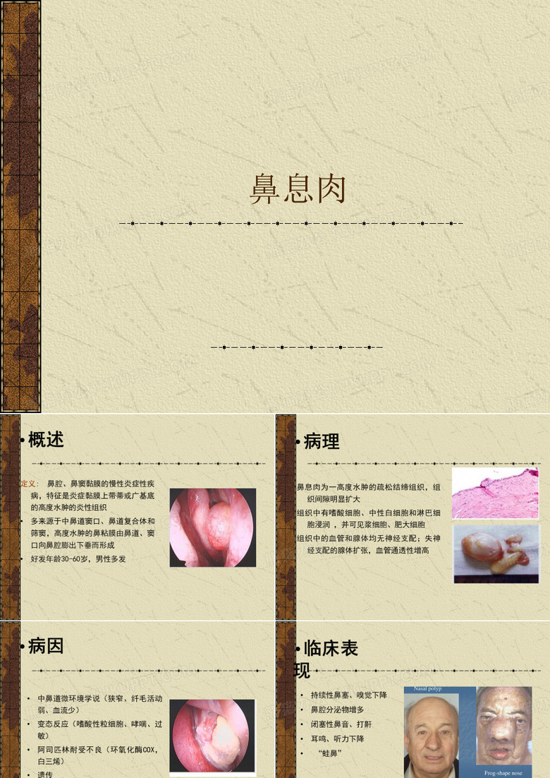 鼻息肉、鼻出血