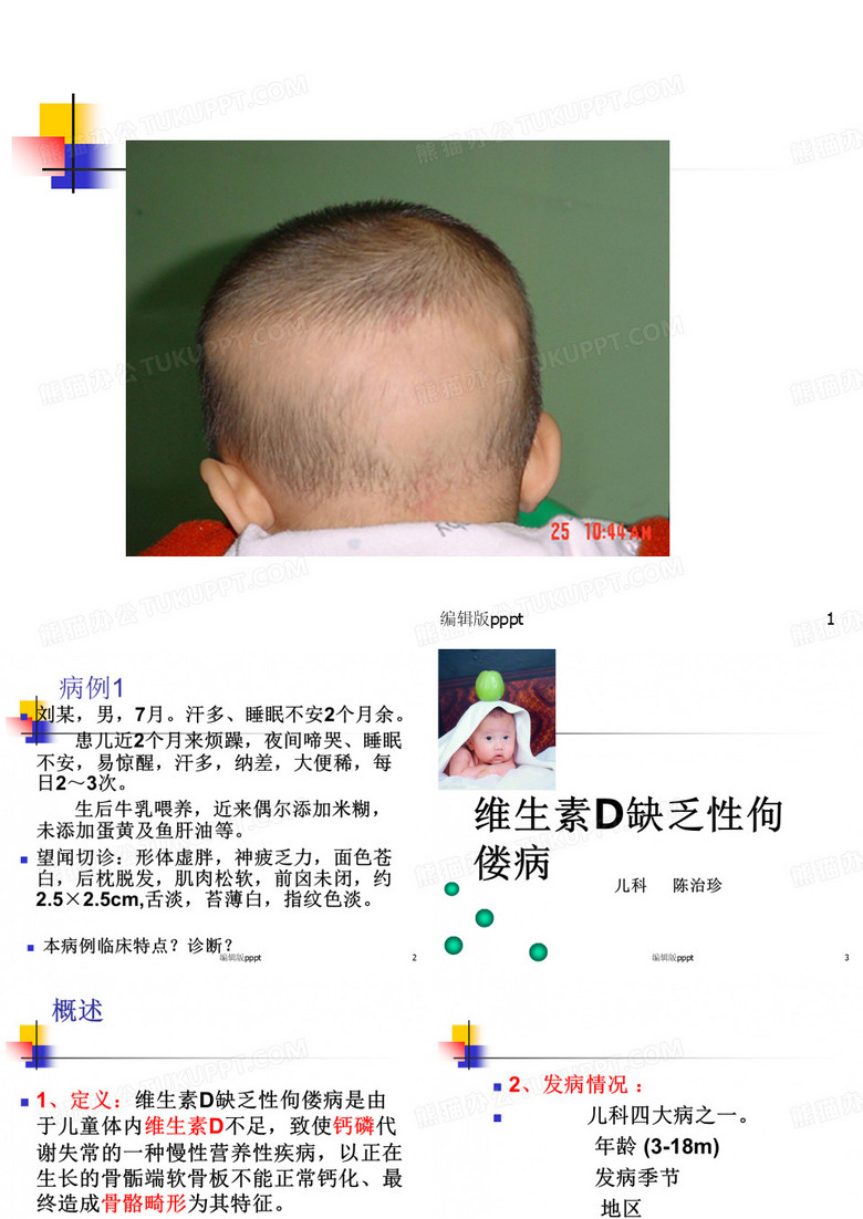 佝偻病(新)