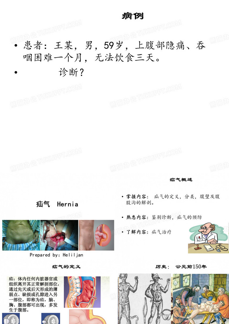 完整版  疝气