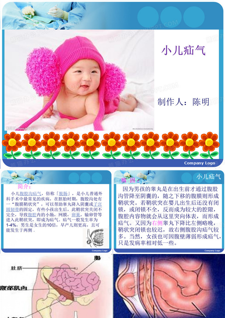 小儿疝气