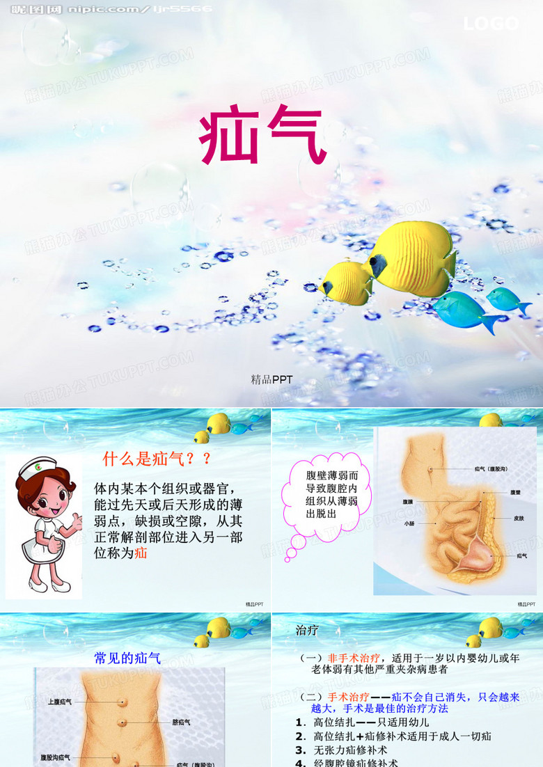 疝气手术配合