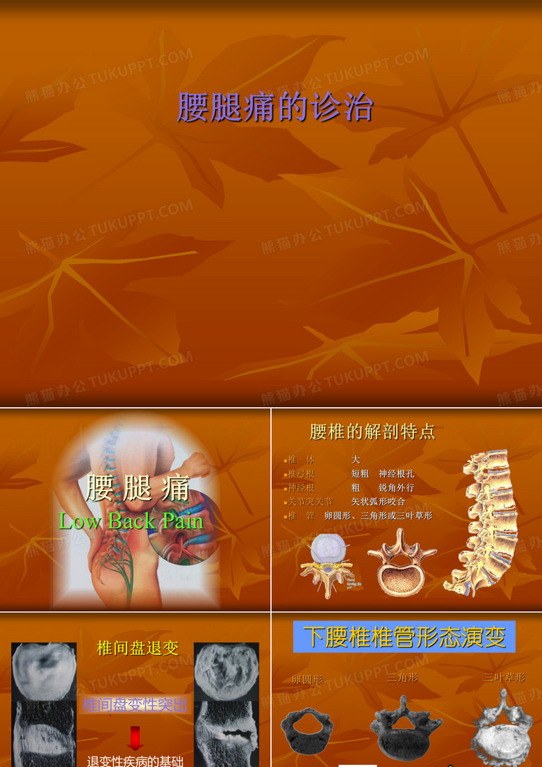 腰腿痛的诊治