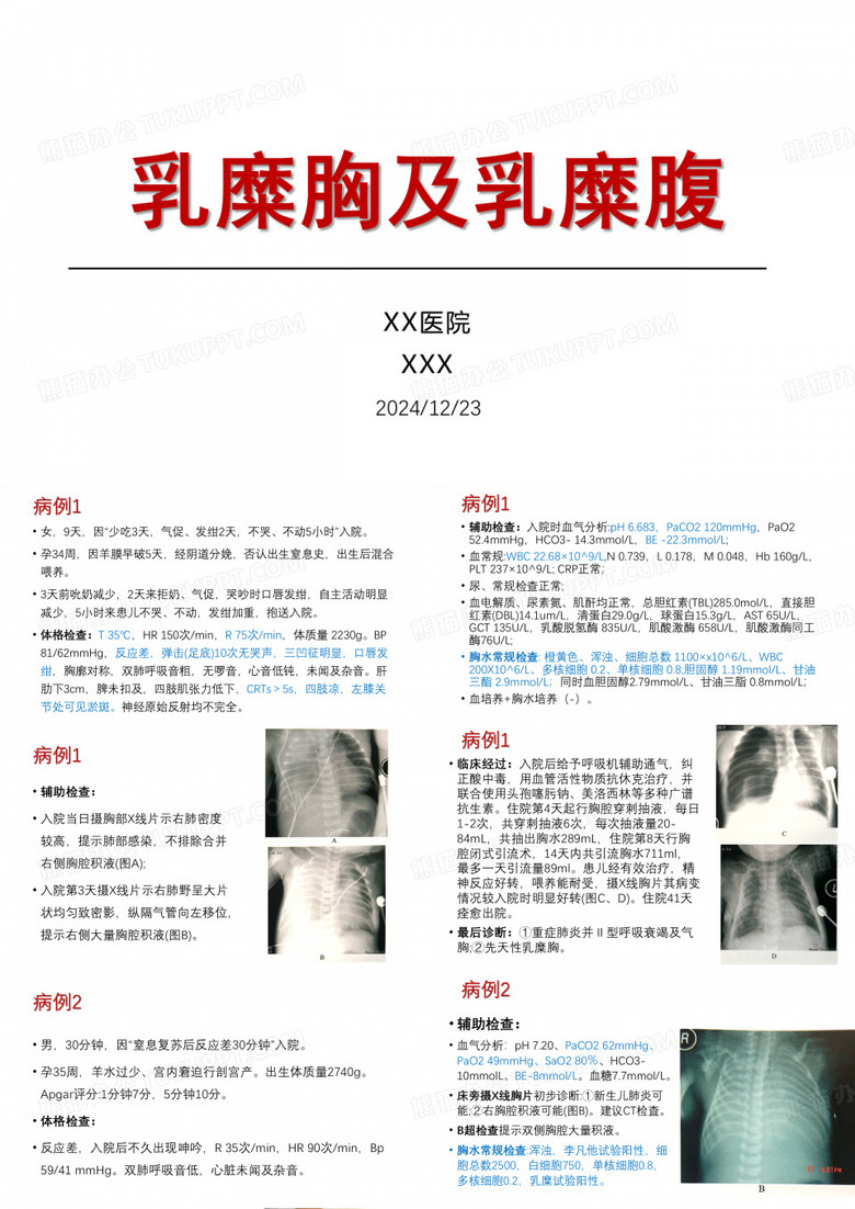 新生儿乳糜胸及乳糜腹