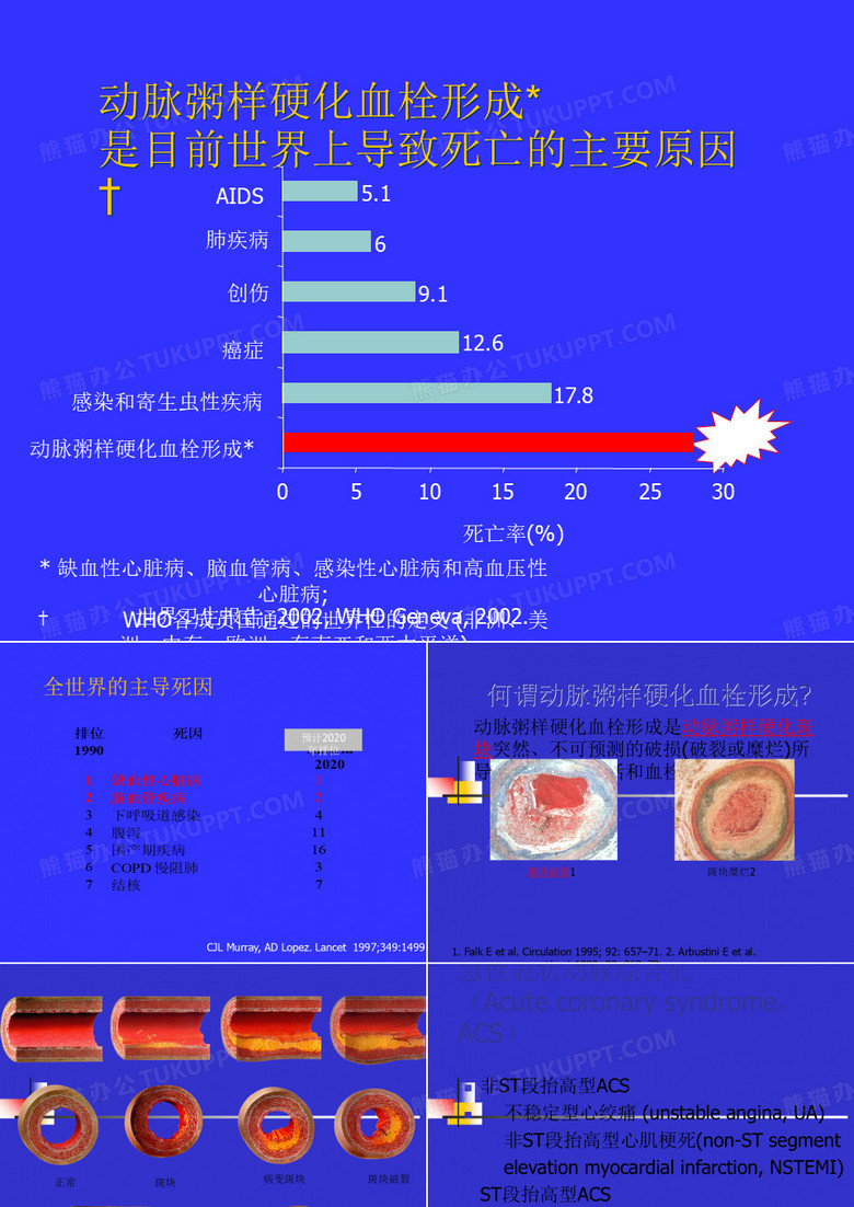 2018年波立维在急冠脉综合症-精品文档资料