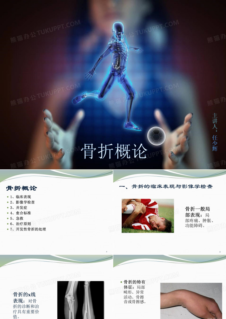 骨折概论