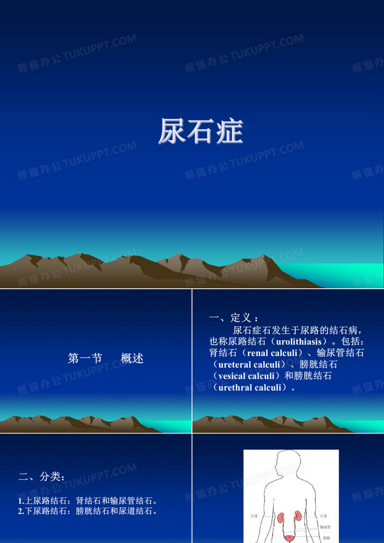 尿石症PPT