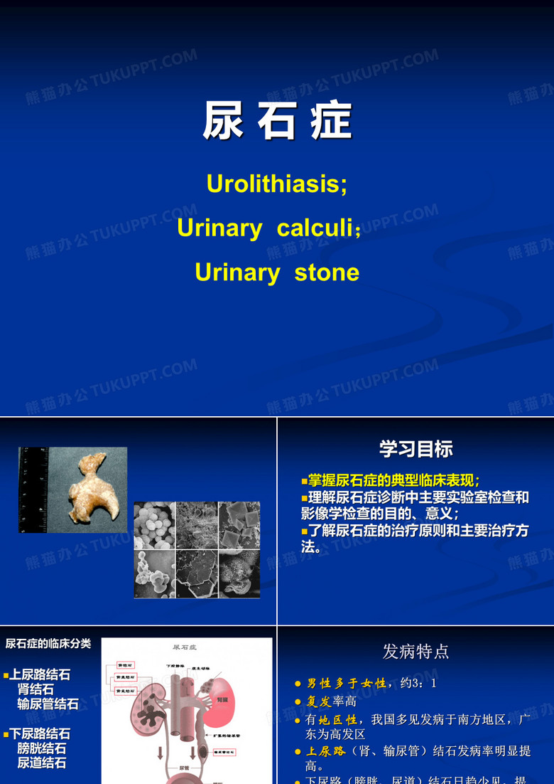 尿石症
