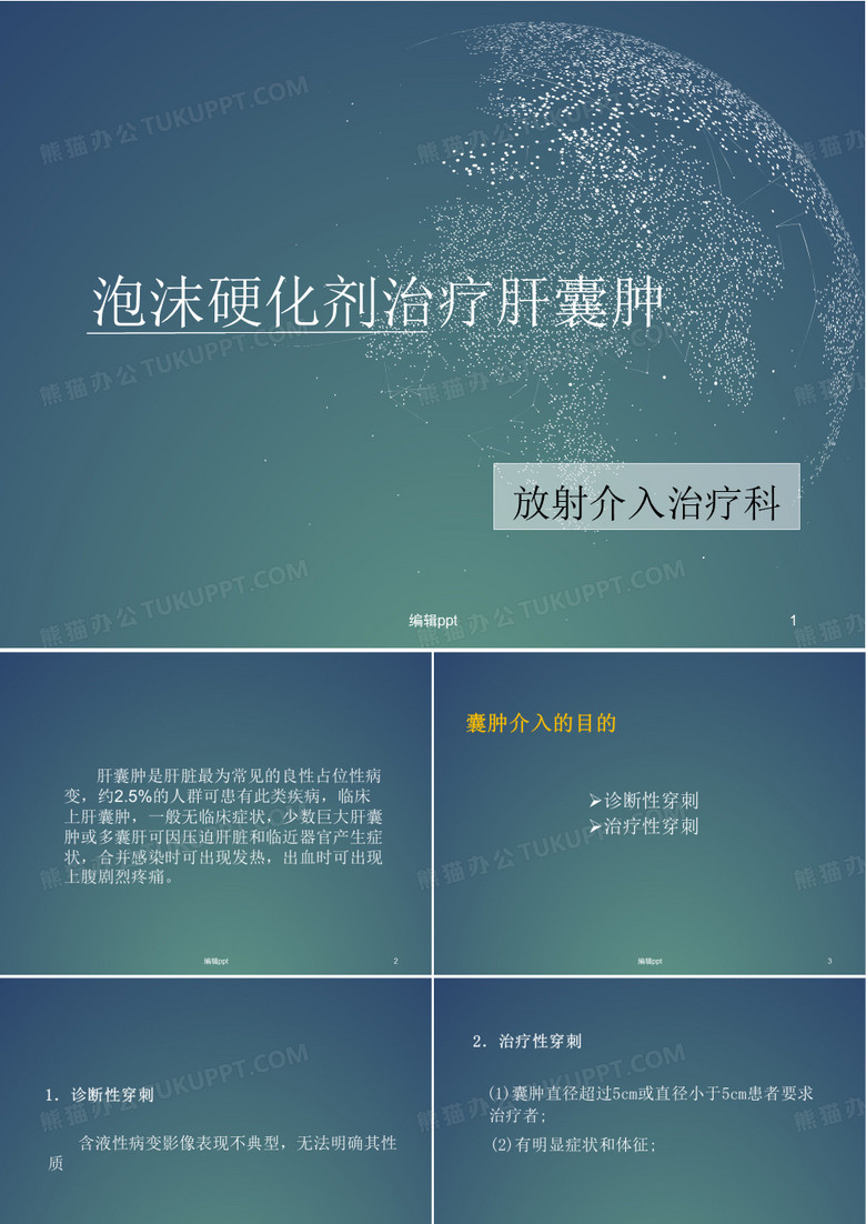 聚桂醇治疗肝囊肿