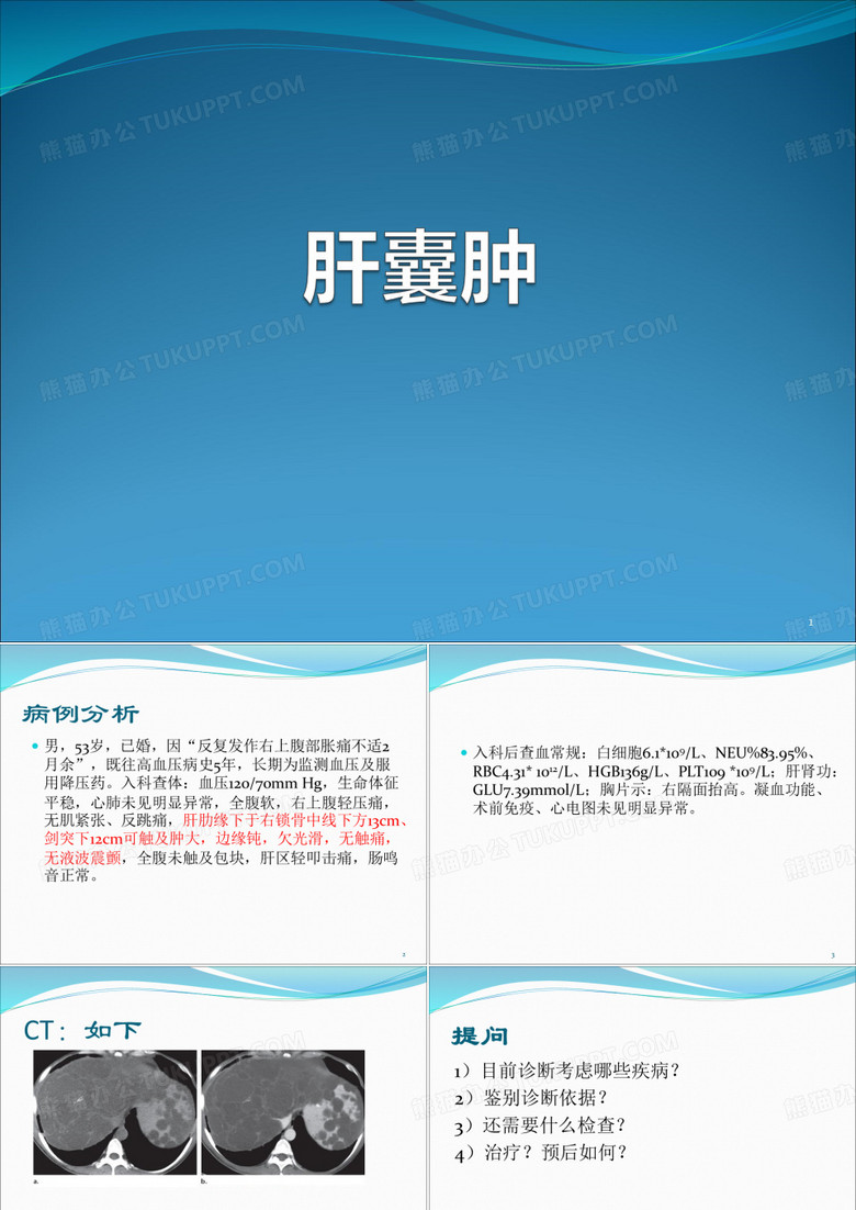 肝囊肿ppt课件