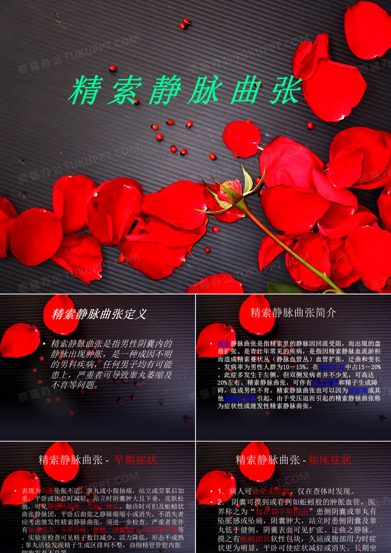 精索静脉曲张课件