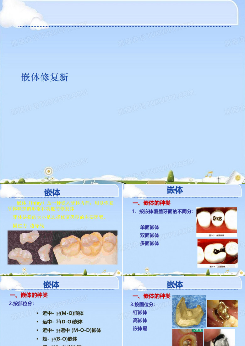 嵌体修复新