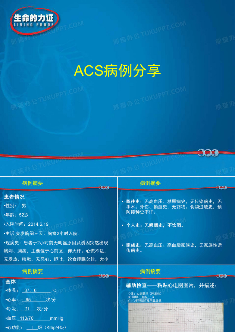 赛诺菲,氯吡格雷 病例住院部UA NSTEMI药物治疗