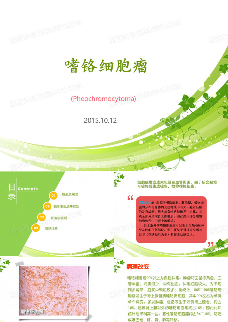 嗜铬细胞瘤