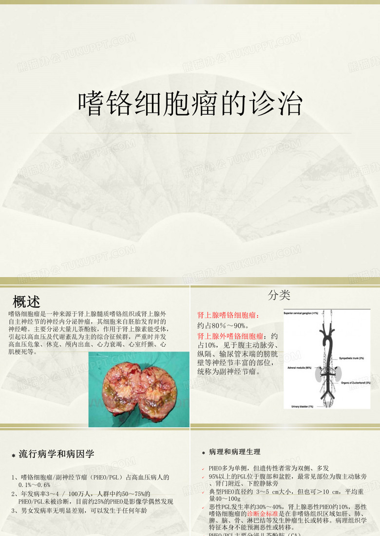 嗜铬细胞瘤