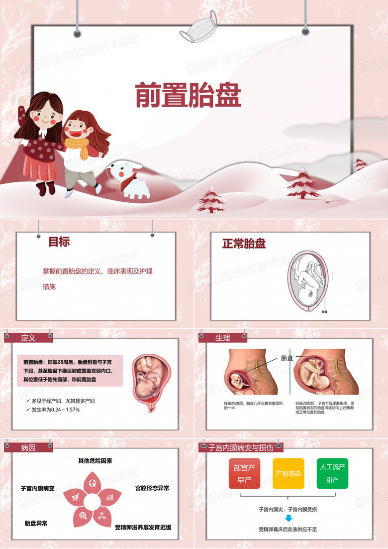 前置胎盘的护理