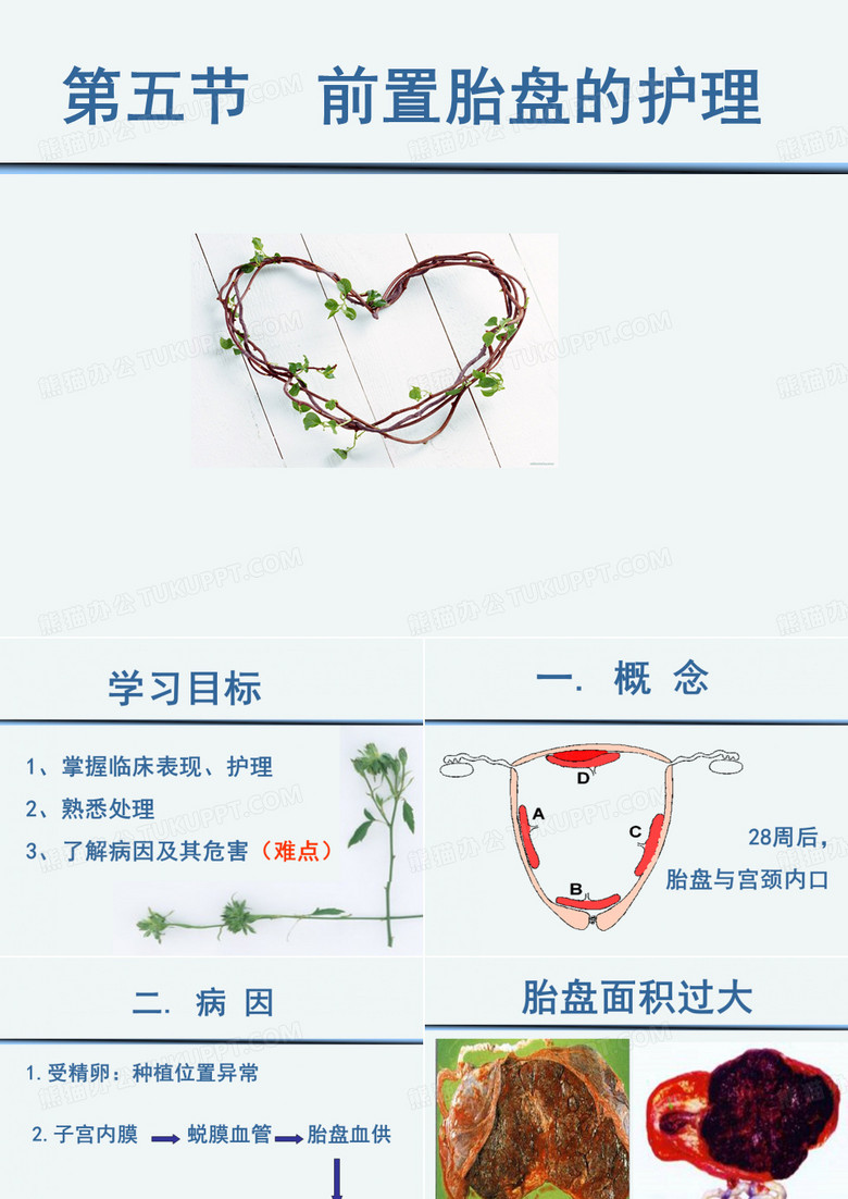 前置胎盘的护理