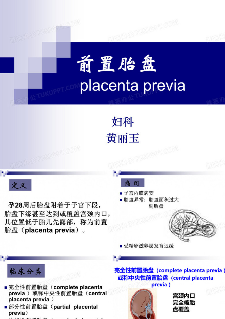 前置胎盘的护理
