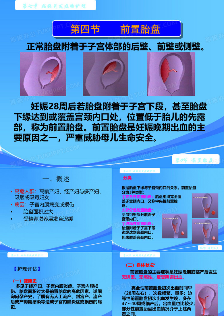 前置胎盘护理