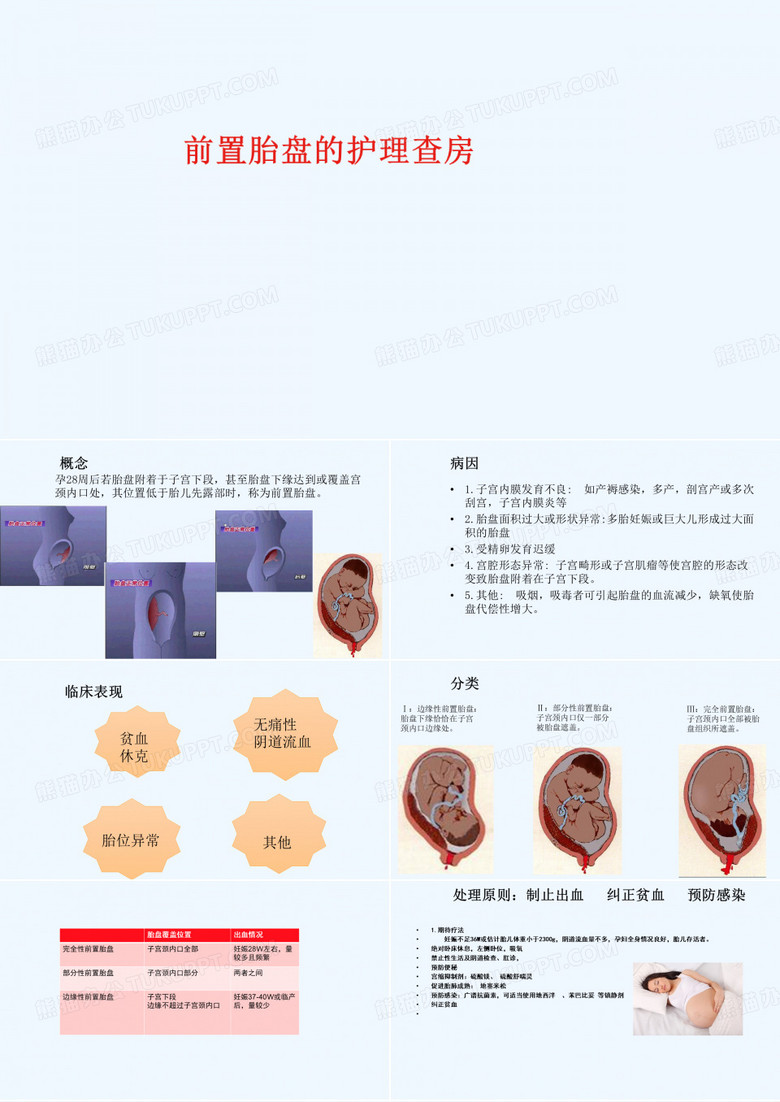 前置胎盘护理查房