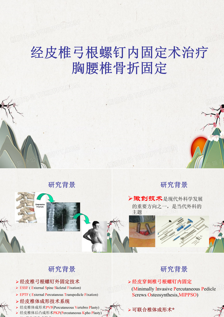 经皮椎弓根螺钉内固定术治疗胸腰椎骨折固定