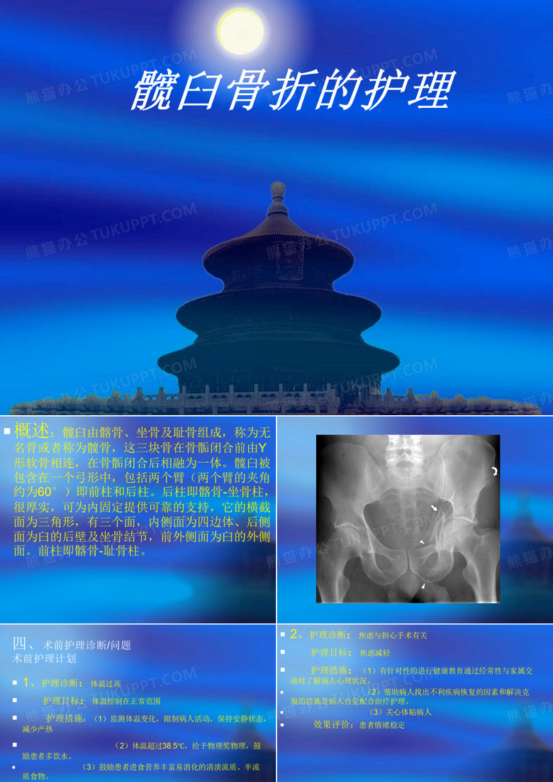 髋臼骨折的护理