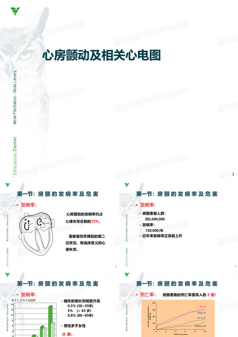 心房颤动心电图