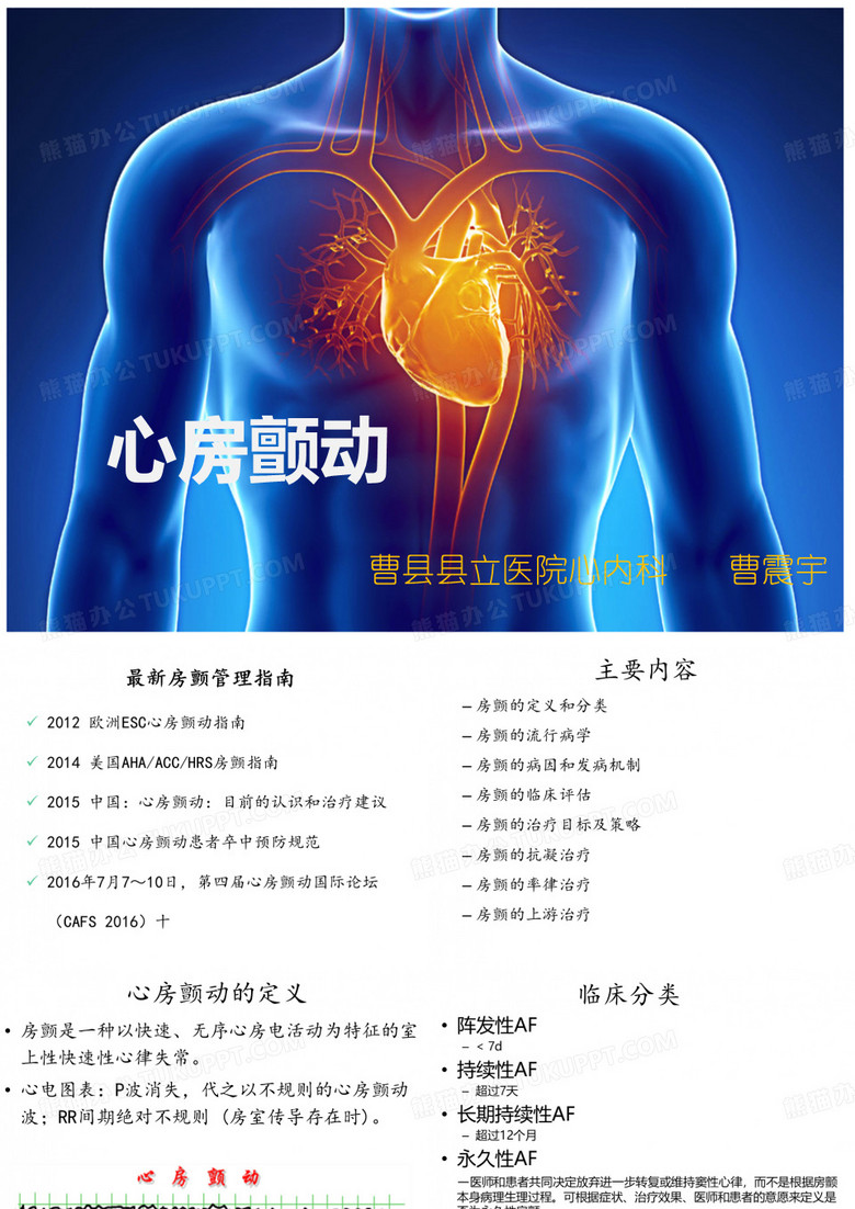 心房颤动进展