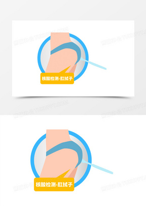 核酸检测肛拭子姿势图片