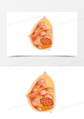 手绘医疗乳腺癌症免抠元素