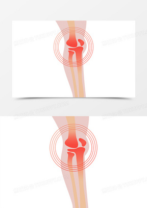 手绘人体膝关节疼痛元素