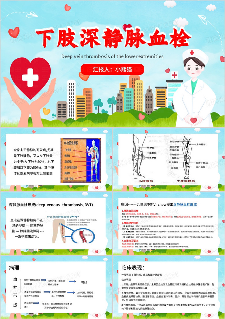 蓝色简约风下肢深静脉血栓PPT模板