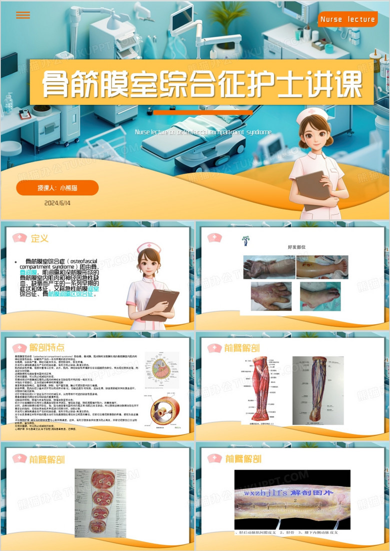 绿色卡通风骨筋膜室综合征PPT模板