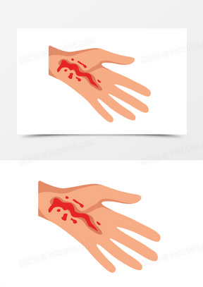 手绘手部受伤元素660伤口流血装饰素材441手绘卡通小刀划伤手素材390