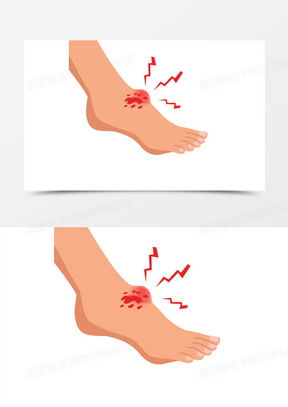 正常人脚踝图片卡通