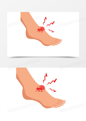 漫画脚扭伤图片