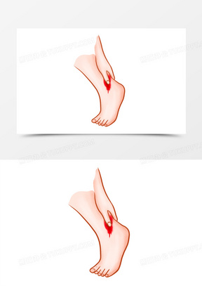 手绘卡通脚踝部受伤元素