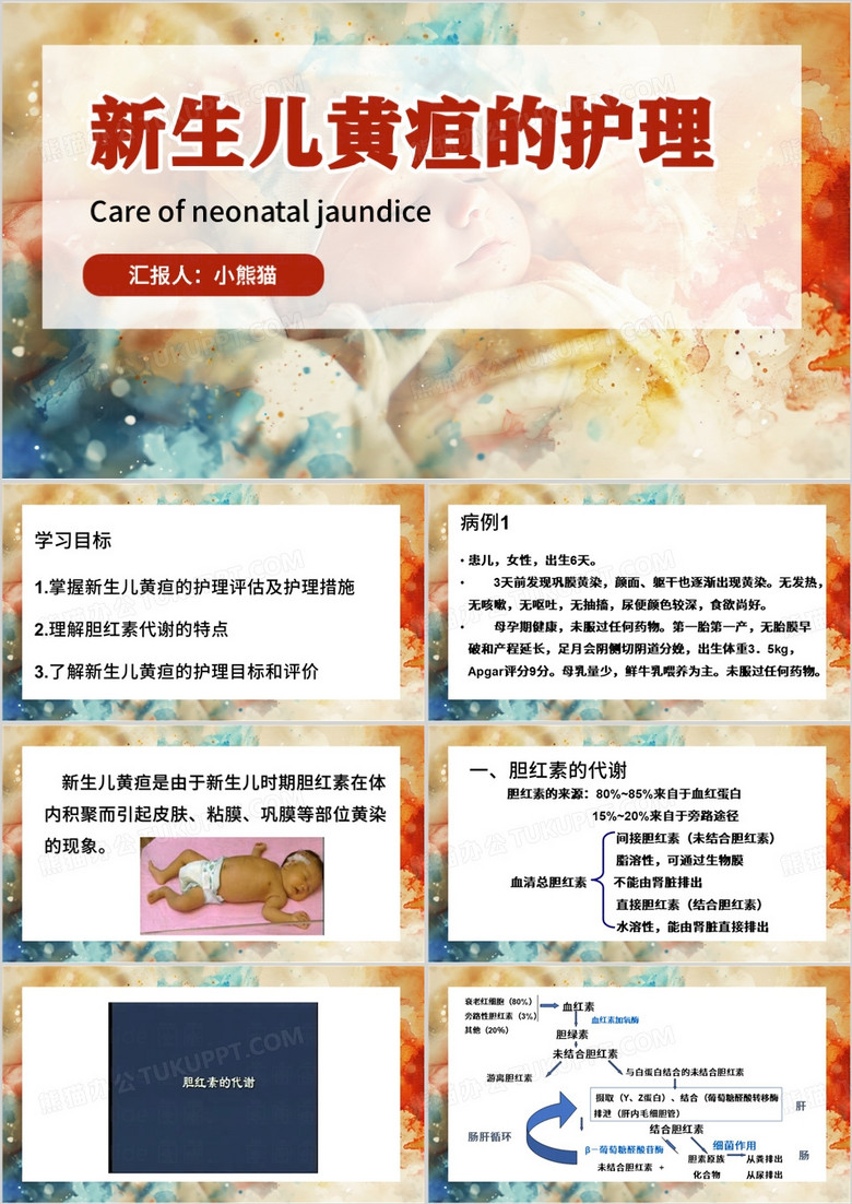 橙色简约风新生儿黄疸护理PPT模板