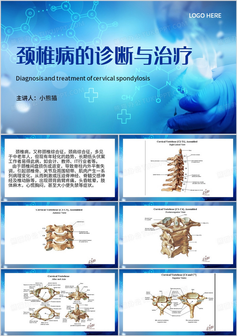 蓝色简约风颈椎病的诊断与治疗PPT模板