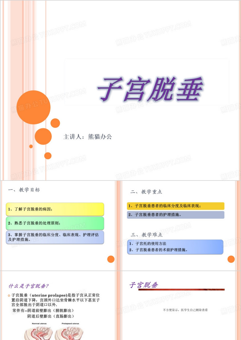 子宫脱垂