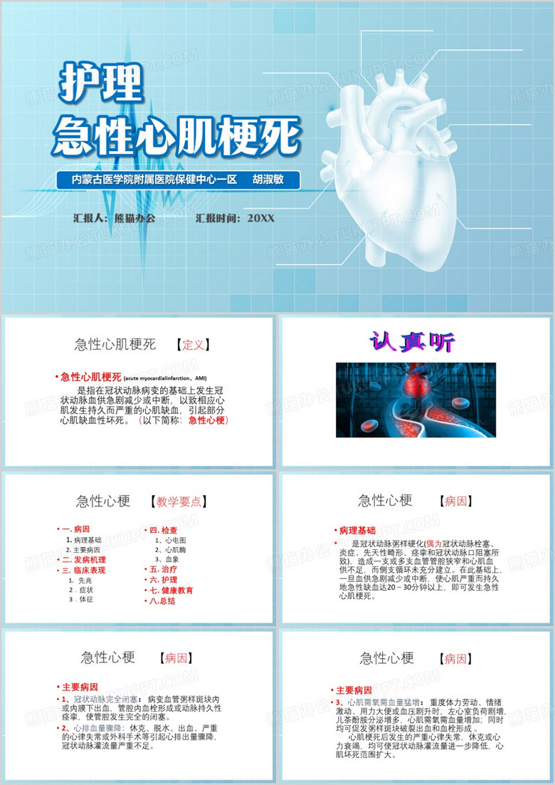 蓝色简约风急性心肌梗死PPT模板