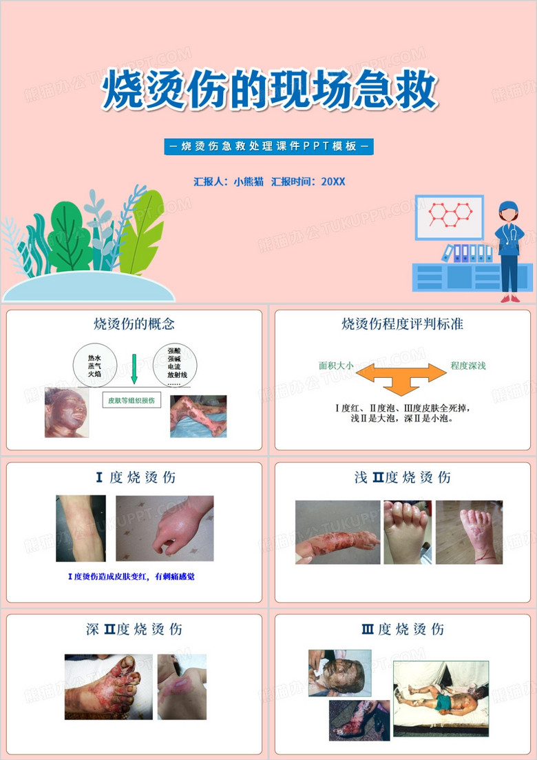 简约手绘卡通烧烫伤急救处理课件ppt模版
