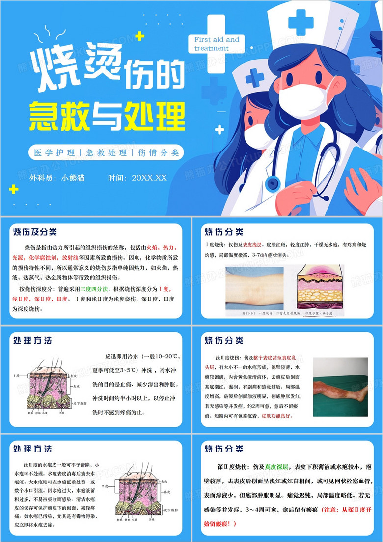 蓝色卡通风烧烫伤的急救与处理PPT模板