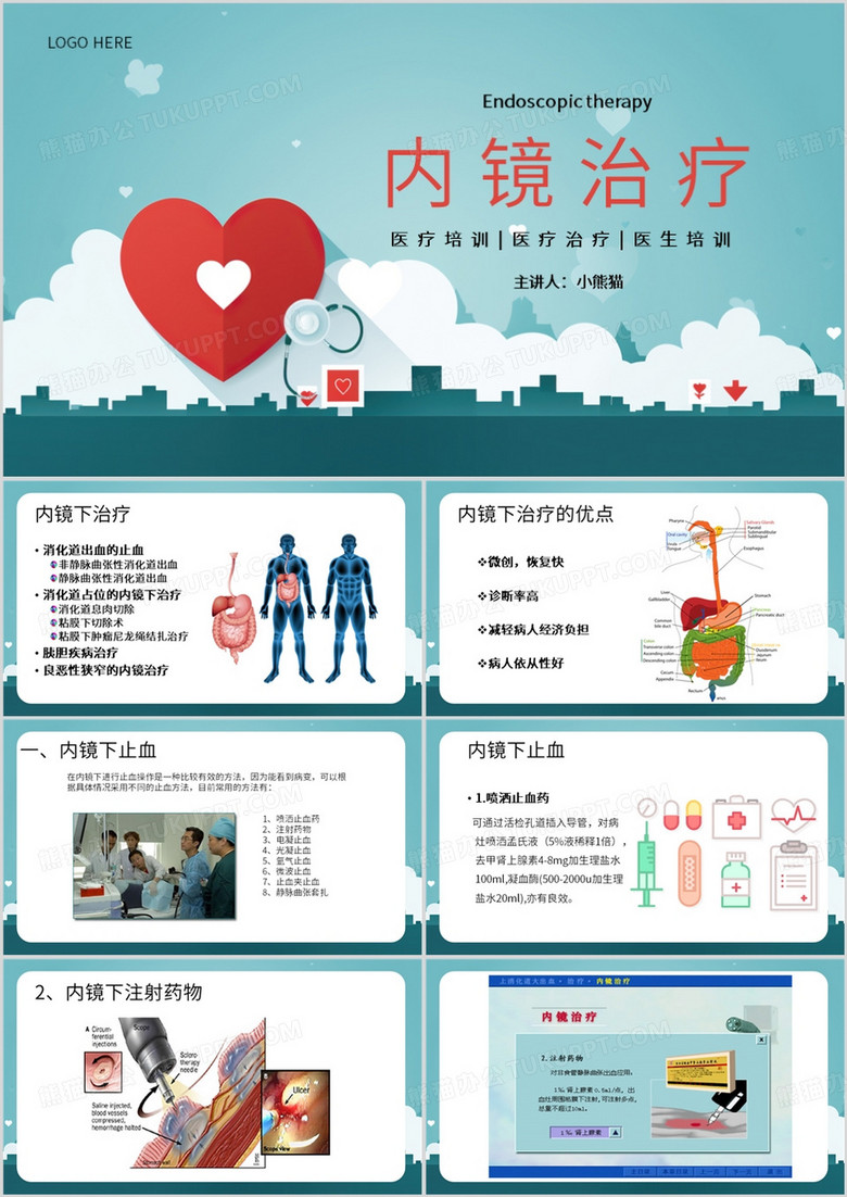 绿色简约风医疗消化内镜治疗PPT模板