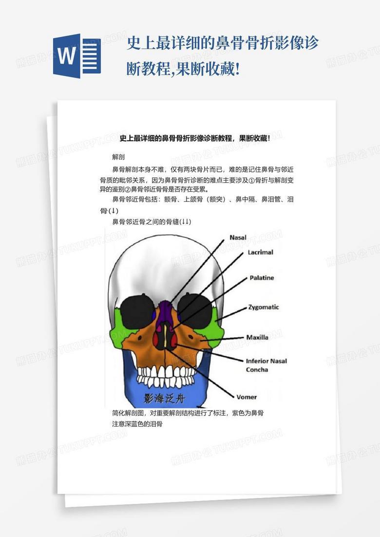 史上最详细的鼻骨骨折影像诊断教程,果断收藏!