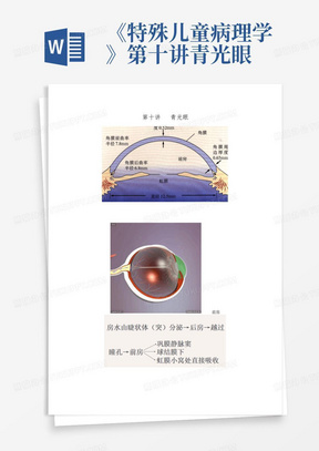 《特殊儿童病理学》第十讲青光眼