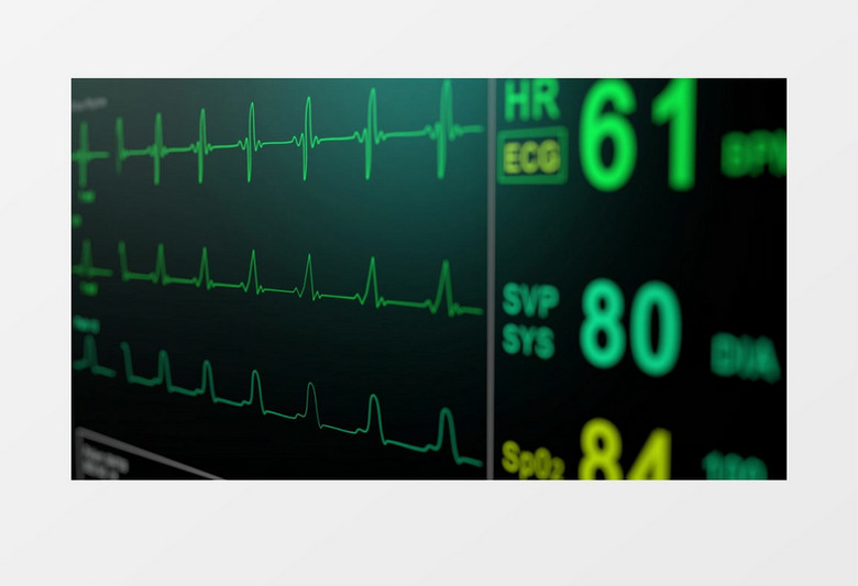 心电图调动实拍素材