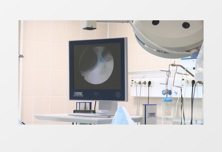 高清显示医用探测仪探测病人身体实拍视频素材