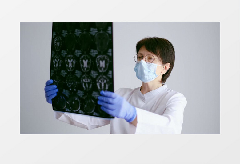 戴眼镜女医生在看患者的X光片实拍视频素材
